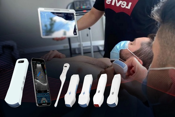 Kablosuz ultrason probu: tıbbi alanda devrim niteliğinde bir araç