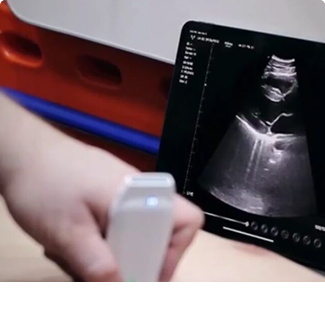 Kardiyolojide kullanılan kablosuz ultrason probu