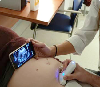 OB & gyn'de kullanılan kablosuz ultrason probu