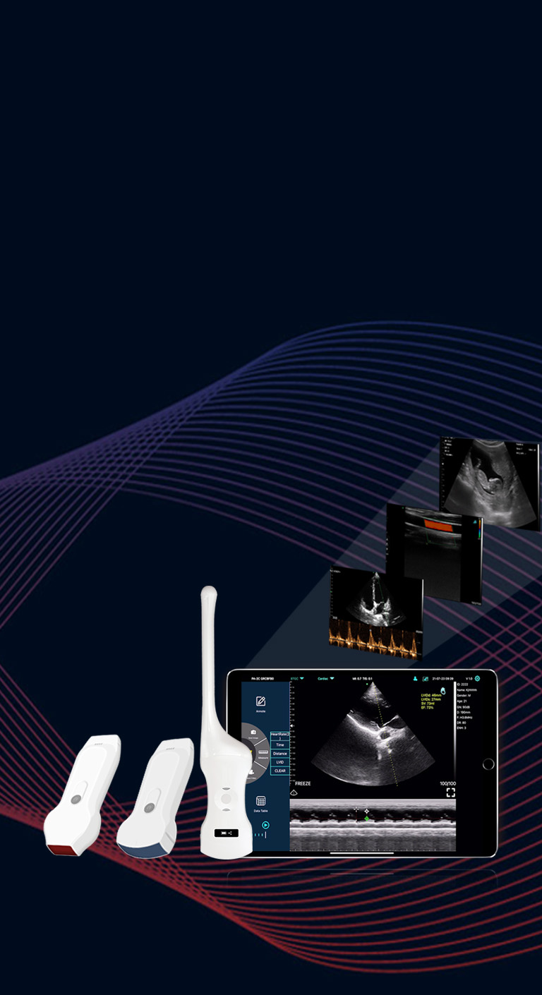 Çift kafa kablosuz ultrason probu